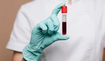 Aké tajomstvá skrývajú krvné skupiny?