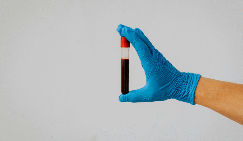 Zákerná otrava krvi. Prvé príznaky vyzerajú nevinne a ľahko sa dajú zameniť