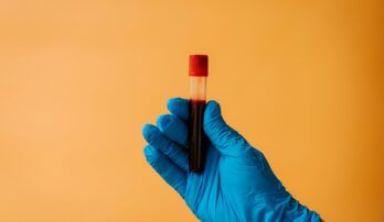 Preventívne krvné testy: Čo dokážu odhaliť?