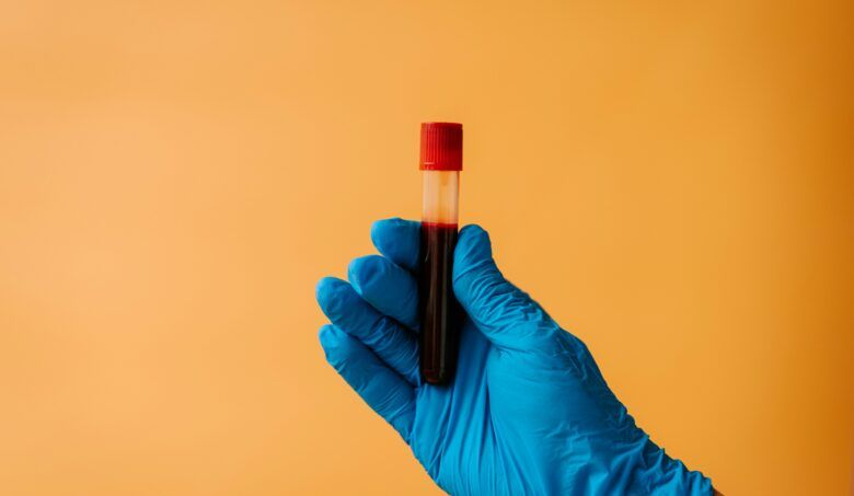 Preventívne krvné testy: Čo dokážu odhaliť?