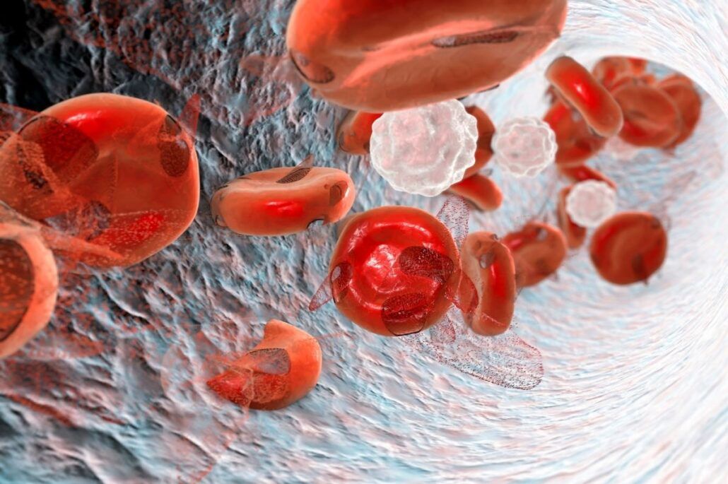 Anémia - červené krvinky prechádzajú žilou