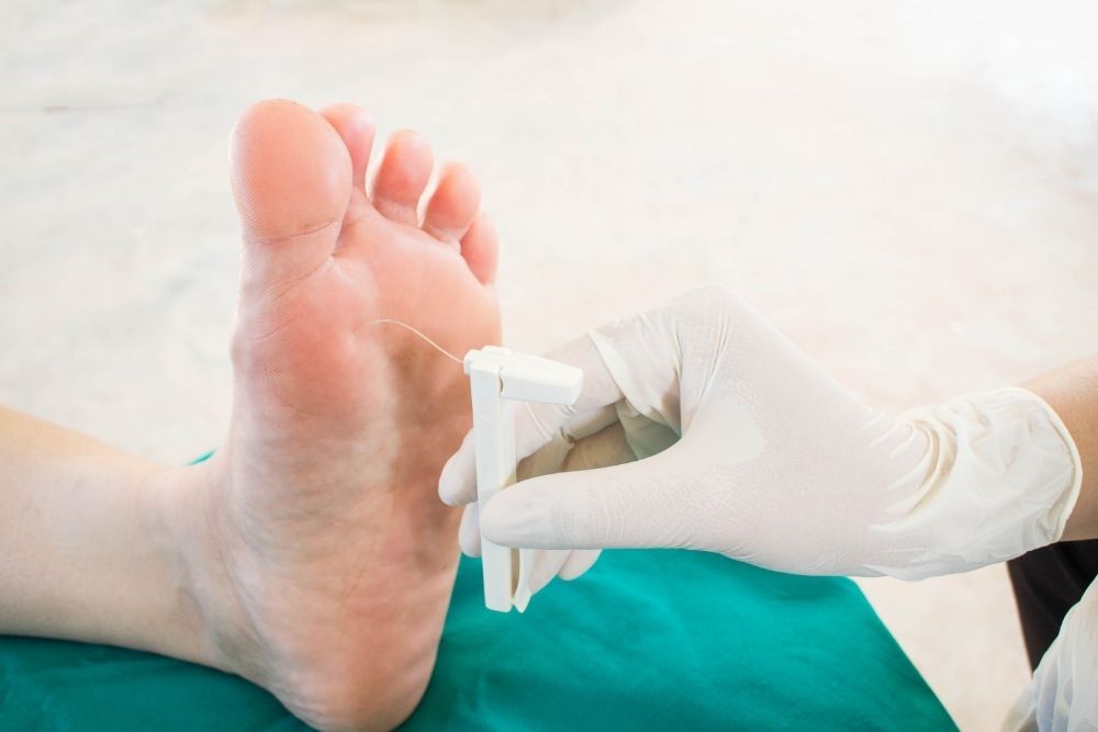 Diabetická neuropatia - screening na chodidle pri cukrovke.
