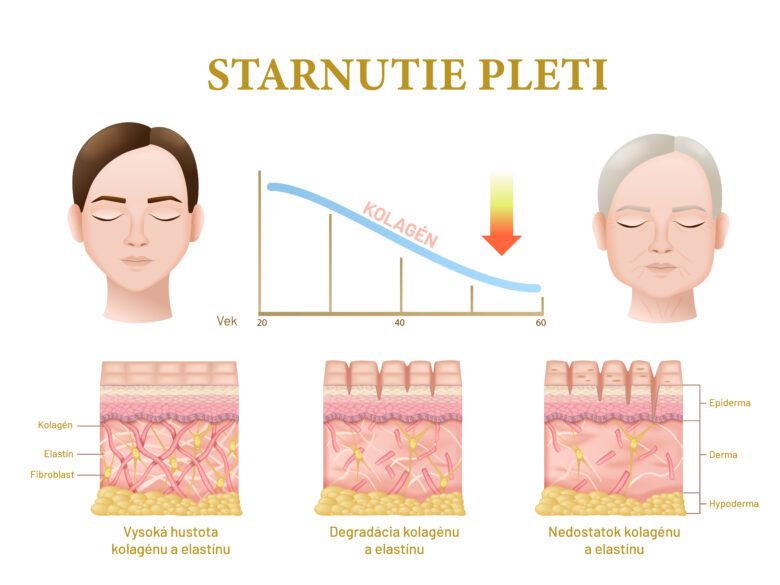 Infografika o starnutí pleti, ktorý zobrazuje ako sa starnutím pleti zhoršuje jej elasticita a znižuje množstvo kolagénu,