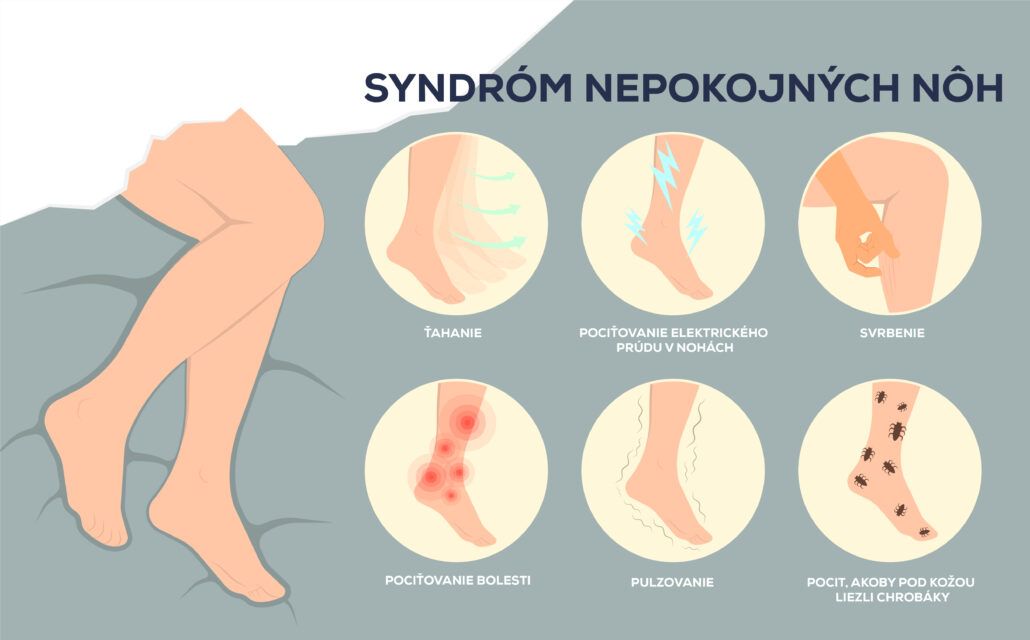 Príznaky syndrómu nepokojných nôh - ťahanie, mravčenie, pulzovanie.