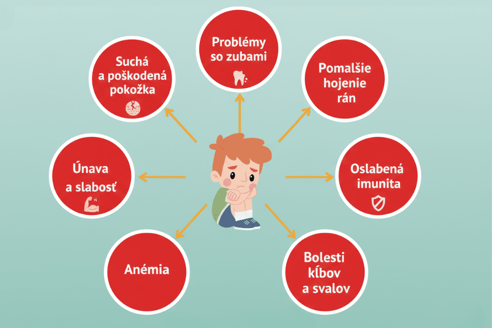 Infografika zobrazuje jednotlivé príznaky nedostatku vitamínu C u detí ako sú problémy so zubami, oslabená imunita, anémia či pomalšie hojenie rán.