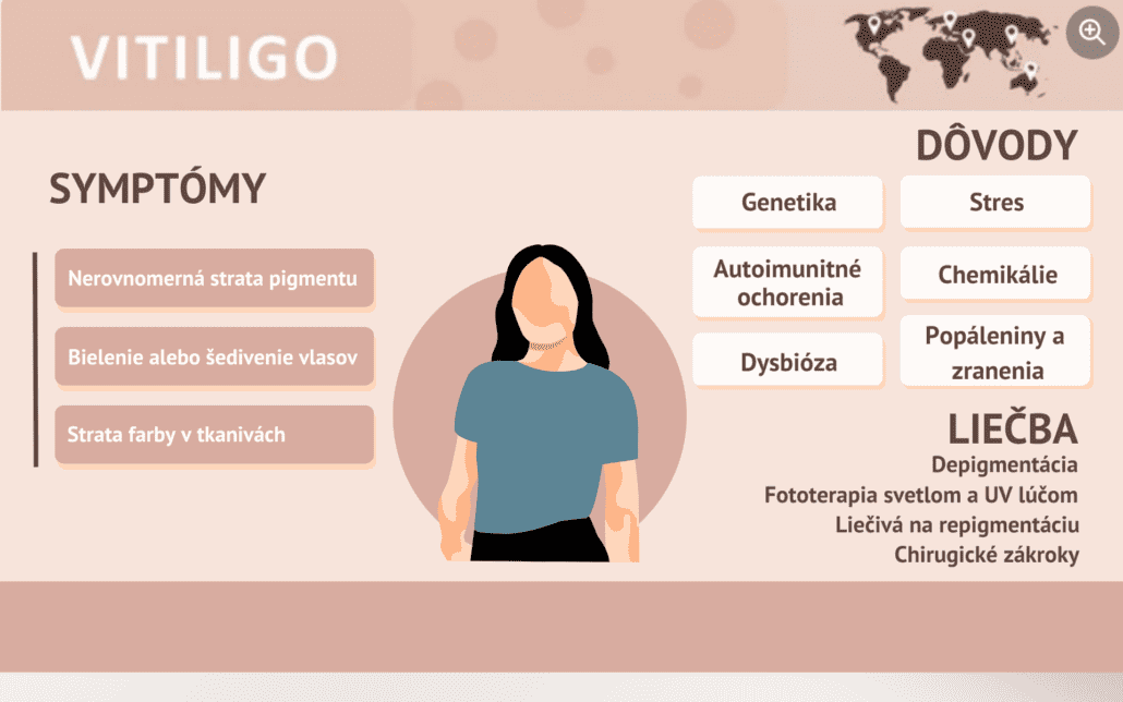 Infografika o symptómoch, dôvodoch a liečbe vitiligo. 