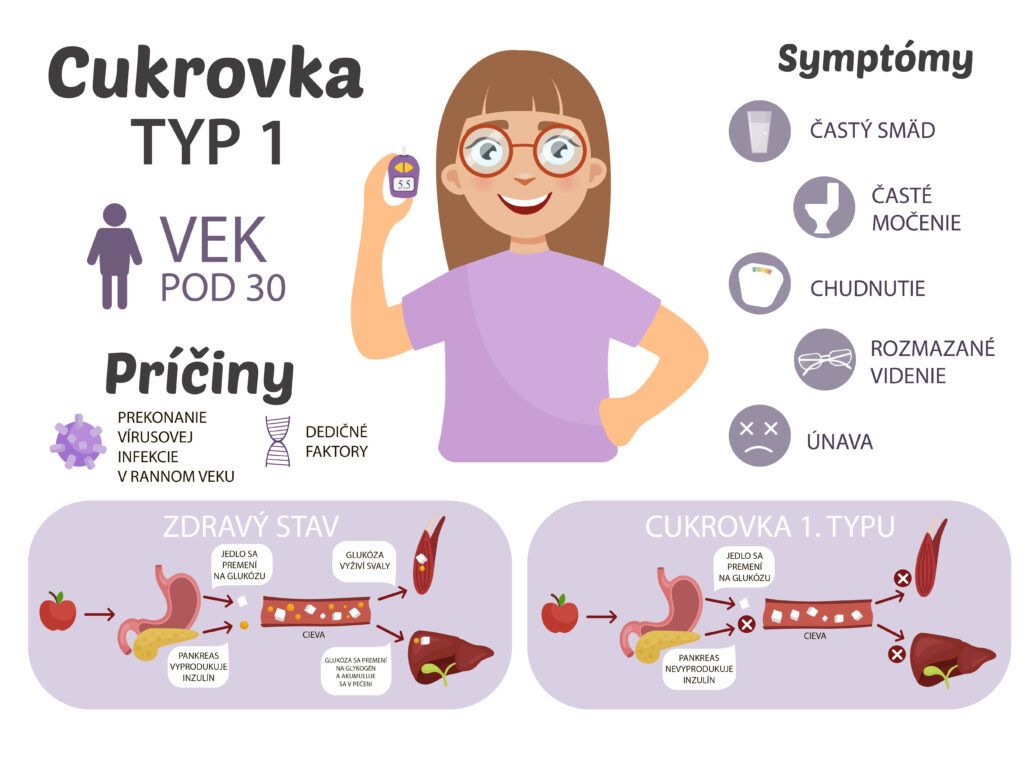 Infografika o 1. type cukrovky, príčiny a symptómy.