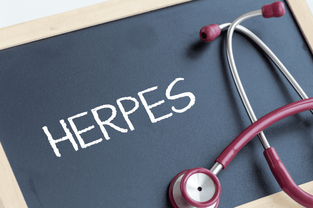 Na tabuľke je napísane slovo herpes a na nej je položený stetoskop.