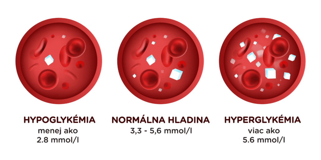 Infografika, ktorá zobrazuje hladiny krvného cukru, ktoré kolíšu aj v závislosti na množstve prijatých sacharidov: hypoglykémiu, normálnu hladinu a hyperglykémiu.