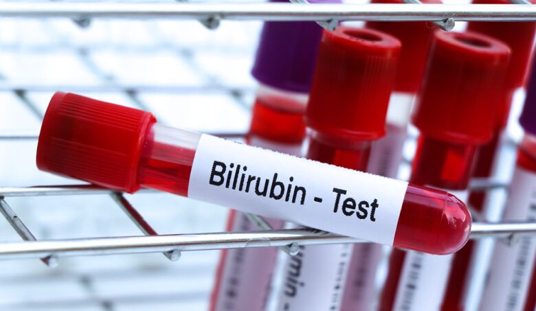 Zvýšený bilirubín: Kedy ide o problém?