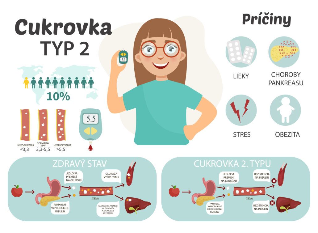 Infografika zobrazujúca 2. typ cukrovky, jej príčiny.