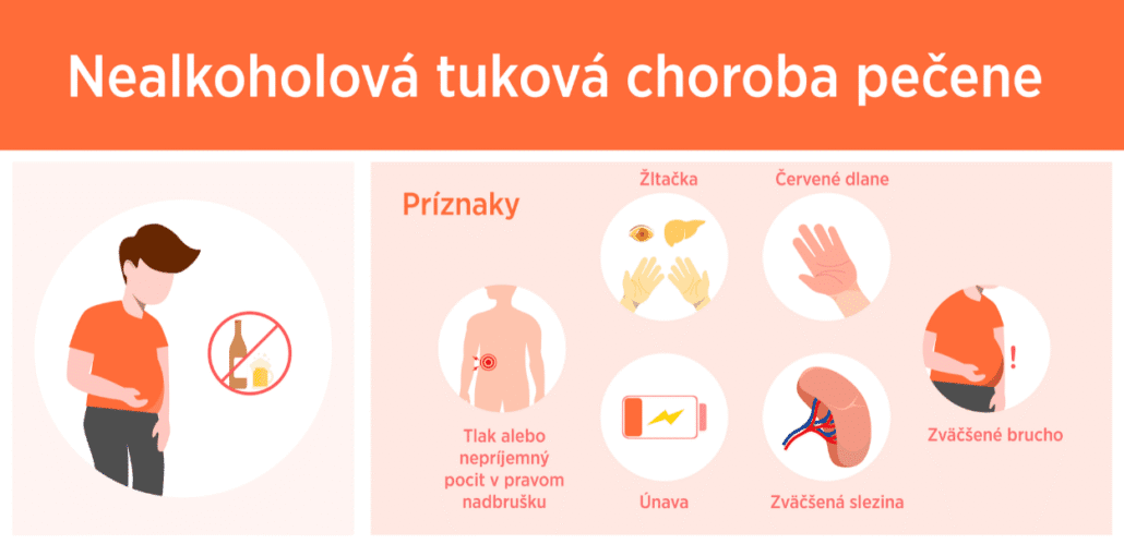Infografika zobrazuje nealkoholovú tukovú chorobu pečene a jej príznaky