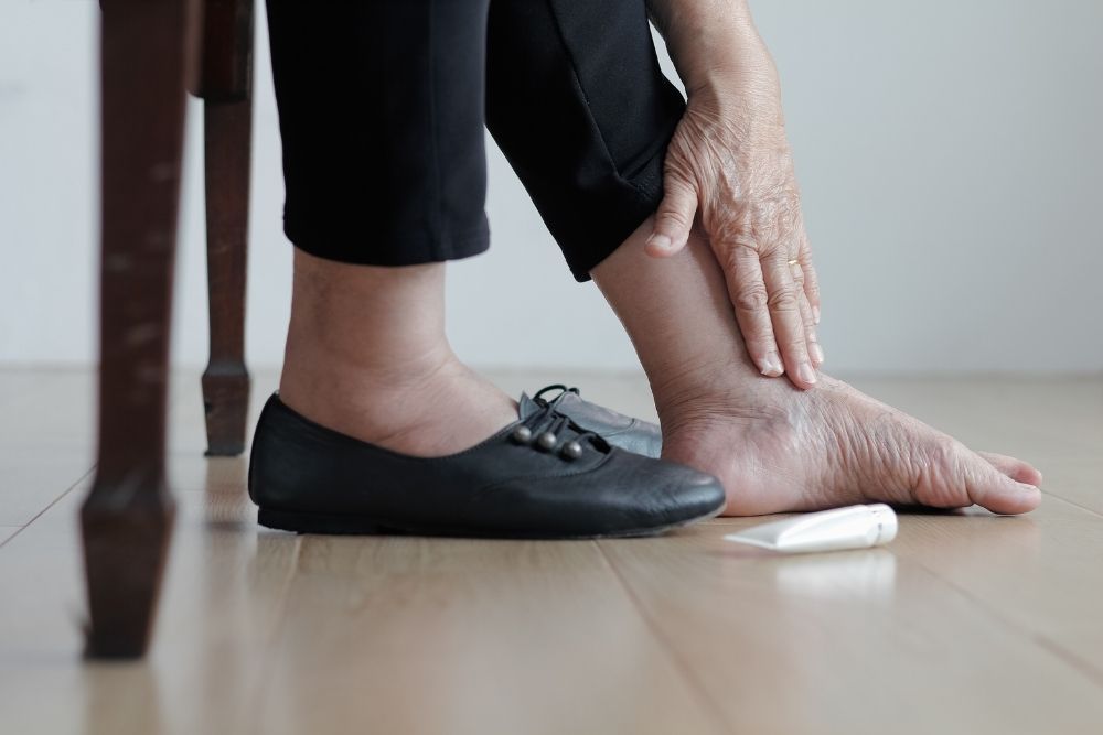 Proximálna neuropatia - opuchy. Žena si natiera opuchnutú nohu krémom.