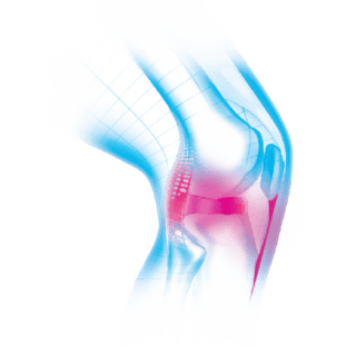 Kolenný kĺb - bolesť - štvorcový rozmer